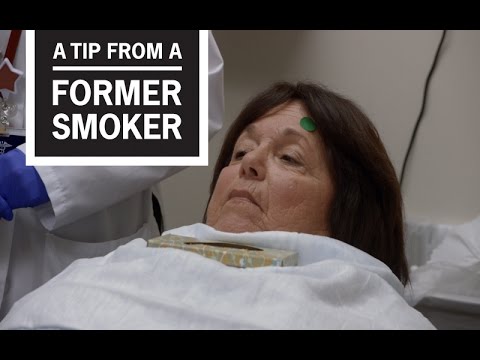 CDC: Tips From Former Smokers – Marlene K.’s Treatment