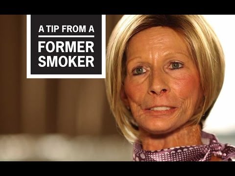 CDC: Tips From Former Smokers – Terrie H.: Little Things I Miss