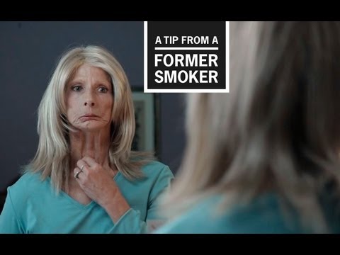 CDC: Tips From Former Smokers – Terrie H.’s Tip Ad
